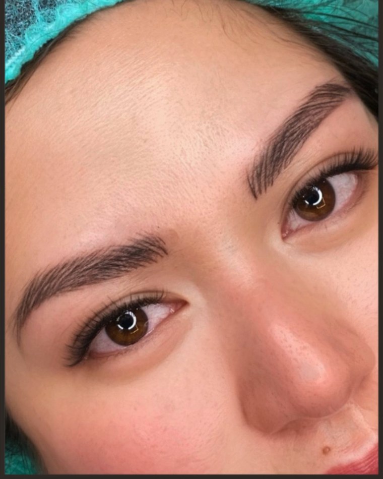 After treatment